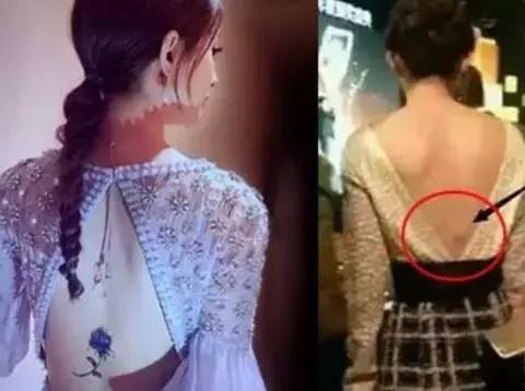 明星网红腰伤,明星网红腰痛背后的真相与预防之道