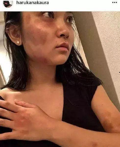 最新热门吃瓜事件是什么,揭秘某明星惊人内幕